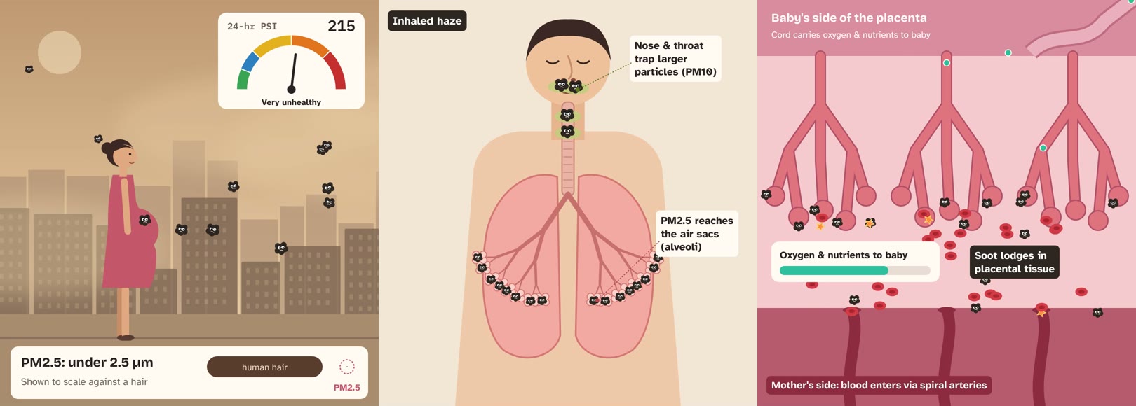 How haze reaches the baby: PM2.5 in a hazy city, breathed deep into the lungs, then reaching the placenta